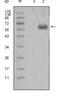 Dickkopf WNT Signaling Pathway Inhibitor 1 antibody, abx010643, Abbexa, Enzyme Linked Immunosorbent Assay image 