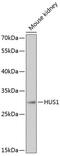 HUS1 Checkpoint Clamp Component antibody, 15-278, ProSci, Western Blot image 