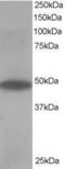 Oxysterol Binding Protein Like 1A antibody, GTX10151, GeneTex, Western Blot image 