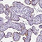 Disintegrin and metalloproteinase domain-containing protein 12 antibody, HPA030867, Atlas Antibodies, Immunohistochemistry paraffin image 