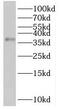 RIB43A Domain With Coiled-Coils 2 antibody, FNab07292, FineTest, Western Blot image 