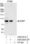 KH-Type Splicing Regulatory Protein antibody, A302-022A, Bethyl Labs, Immunoprecipitation image 