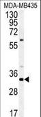 SAGA-associated factor 29 homolog antibody, LS-C169042, Lifespan Biosciences, Western Blot image 