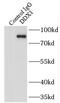 DEAD-Box Helicase 1 antibody, FNab02294, FineTest, Immunoprecipitation image 