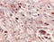 Matrix metalloproteinase-24 antibody, AB924, R&D Systems, Immunohistochemistry frozen image 