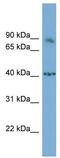 Nuclear factor of activated T-cells, cytoplasmic 1 antibody, TA343585, Origene, Western Blot image 