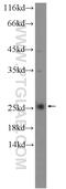 Leucine Rich Repeat Containing 20 antibody, 25562-1-AP, Proteintech Group, Western Blot image 