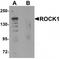 Rho Associated Coiled-Coil Containing Protein Kinase 1 antibody, TA319700, Origene, Western Blot image 