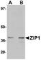 Zinc transporter ZIP1 antibody, orb75530, Biorbyt, Western Blot image 