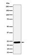 Ras-related protein Rab-5C antibody, M05148-1, Boster Biological Technology, Western Blot image 