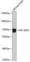 NADH-ubiquinone oxidoreductase chain 5 antibody, 23-423, ProSci, Western Blot image 