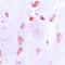 Hypermethylated in cancer 2 protein antibody, orb215070, Biorbyt, Immunohistochemistry paraffin image 
