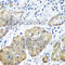 Phospholipase C Beta 2 antibody, A8141, ABclonal Technology, Immunohistochemistry paraffin image 
