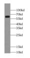 Rabaptin, RAB GTPase Binding Effector Protein 2 antibody, FNab07055, FineTest, Western Blot image 