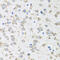 Ribosomal Protein Lateral Stalk Subunit P1 antibody, 22-439, ProSci, Immunohistochemistry paraffin image 