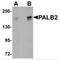 Partner And Localizer Of BRCA2 antibody, MBS150755, MyBioSource, Western Blot image 