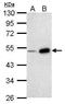 Bone Morphogenetic Protein 4 antibody, GTX100874, GeneTex, Western Blot image 