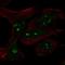 MYCN Proto-Oncogene, BHLH Transcription Factor antibody, HPA057420, Atlas Antibodies, Immunocytochemistry image 