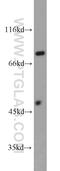 Phosphofructokinase, Platelet antibody, 13389-1-AP, Proteintech Group, Western Blot image 