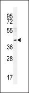 MTS antibody, PA5-35114, Invitrogen Antibodies, Western Blot image 
