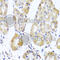 Mitochondrial Ribosomal Protein L11 antibody, A4945, ABclonal Technology, Immunohistochemistry paraffin image 