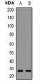 Oxidized Low Density Lipoprotein Receptor 1 antibody, orb381928, Biorbyt, Western Blot image 