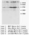 C-X-C Motif Chemokine Receptor 4 antibody, AP23316PU-N, Origene, Western Blot image 