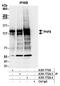 PHD Finger Protein 8 antibody, A301-772A, Bethyl Labs, Immunoprecipitation image 