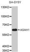 N-Acylsphingosine Amidohydrolase 1 antibody, MBS128588, MyBioSource, Western Blot image 
