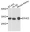 Cholinergic Receptor Nicotinic Alpha 7 Subunit antibody, orb373089, Biorbyt, Western Blot image 