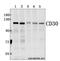 TNF Receptor Superfamily Member 8 antibody, GTX66609, GeneTex, Western Blot image 