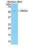 Killer Cell Immunoglobulin Like Receptor, Three Ig Domains And Long Cytoplasmic Tail 2 antibody, LS-C302600, Lifespan Biosciences, Western Blot image 