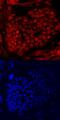 PR/SET Domain 14 antibody, MAB6175, R&D Systems, Immunocytochemistry image 