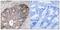 CAD protein antibody, LS-C198710, Lifespan Biosciences, Immunohistochemistry paraffin image 