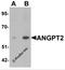 Angiopoietin 2 antibody, 6737, ProSci Inc, Western Blot image 