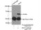 Carboxypeptidase Q antibody, 16601-1-AP, Proteintech Group, Immunoprecipitation image 