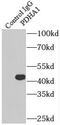 Pyruvate Dehydrogenase E1 Alpha 1 Subunit antibody, FNab06268, FineTest, Immunoprecipitation image 