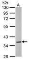 ELMO Domain Containing 1 antibody, PA5-31621, Invitrogen Antibodies, Western Blot image 