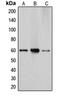 Sterol 26-hydroxylase, mitochondrial antibody, LS-C352098, Lifespan Biosciences, Western Blot image 