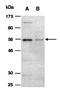 Histone-lysine N-methyltransferase MLL2 antibody, orb66850, Biorbyt, Western Blot image 