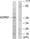 B1AR antibody, LS-C119382, Lifespan Biosciences, Western Blot image 