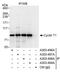 Cyclin T1 antibody, A303-497A, Bethyl Labs, Immunoprecipitation image 