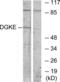 Diacylglycerol Kinase Epsilon antibody, LS-C118928, Lifespan Biosciences, Western Blot image 