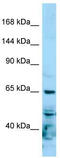 RNA Polymerase II Subunit A antibody, TA343189, Origene, Western Blot image 