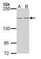 Erythrocyte Membrane Protein Band 4.1 Like 2 antibody, PA5-29485, Invitrogen Antibodies, Western Blot image 