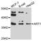 ADP-Ribosyltransferase 1 antibody, abx136013, Abbexa, Western Blot image 
