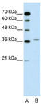 Aminolevulinate Dehydratase antibody, TA346147, Origene, Western Blot image 