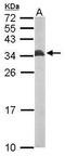 Electron transfer flavoprotein subunit beta antibody, TA308553, Origene, Western Blot image 