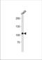 Ubiquitin-protein ligase E3C antibody, TA325160, Origene, Western Blot image 