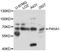Prolyl 4-hydroxylase subunit alpha-1 antibody, A10538, ABclonal Technology, Western Blot image 